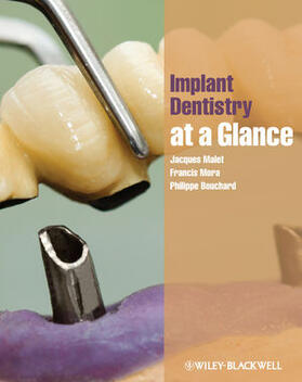 Malet / Mora / Bouchard |  Implant Dentistry at a Glance | Buch |  Sack Fachmedien