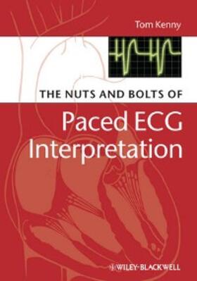 Kenny |  The Nuts and bolts of Paced ECG Interpretation | eBook | Sack Fachmedien