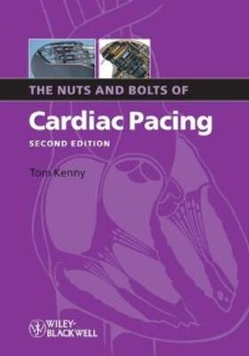 Kenny |  The Nuts and Bolts of Cardiac Pacing | eBook | Sack Fachmedien