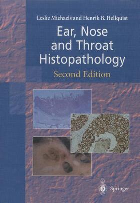 Michaels / Hellquist |  Ear, Nose and Throat Histopathology | Buch |  Sack Fachmedien