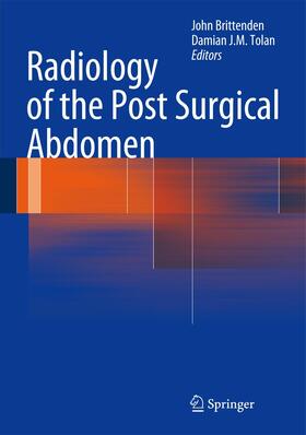 Tolan / Brittenden |  Radiology of the Post Surgical Abdomen | Buch |  Sack Fachmedien