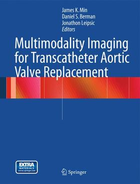 Min / Leipsic / Berman |  Multimodality Imaging for Transcatheter Aortic Valve Replacement | Buch |  Sack Fachmedien