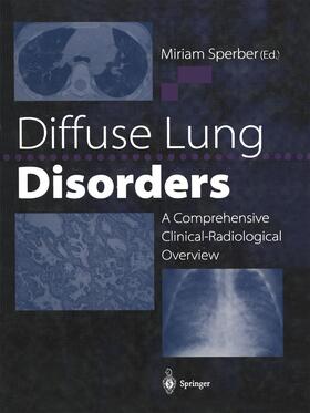 Sperber |  Diffuse Lung Disorders | Buch |  Sack Fachmedien