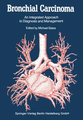 Bates |  Bronchial Carcinoma | Buch |  Sack Fachmedien