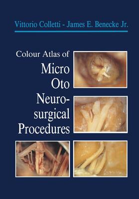 Colletti / Benecke |  Colour Atlas of Micro-Oto-Neurosurgical Procedures | Buch |  Sack Fachmedien