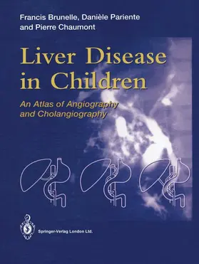 Brunelle / Chaumont / Pariente |  Liver Disease in Children | Buch |  Sack Fachmedien