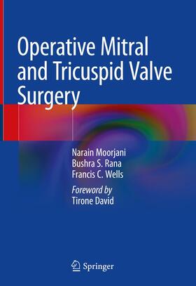 Moorjani / Wells / Rana |  Operative Mitral and Tricuspid Valve Surgery | Buch |  Sack Fachmedien
