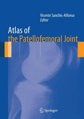 Sanchis-Alfonso |  Atlas of the Patellofemoral Joint | Buch |  Sack Fachmedien