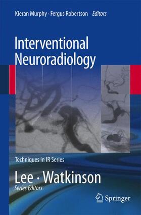 Murphy / Robertson |  Interventional Neuroradiology | Buch |  Sack Fachmedien