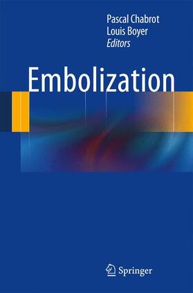 Boyer / Chabrot |  Embolization | Buch |  Sack Fachmedien