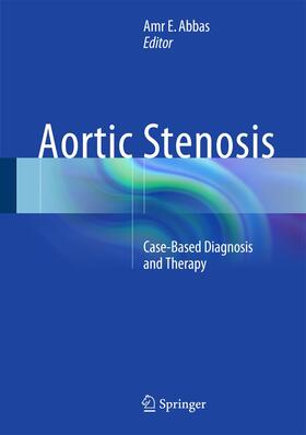 Abbas |  Aortic Stenosis | Buch |  Sack Fachmedien