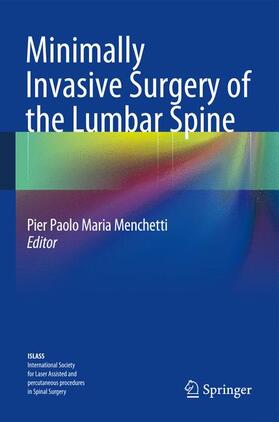 Menchetti |  Minimally Invasive Surgery of the Lumbar Spine | Buch |  Sack Fachmedien
