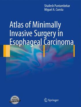 Cuesta / Puntambekar |  Atlas of Minimally Invasive Surgery in Esophageal Carcinoma | Buch |  Sack Fachmedien