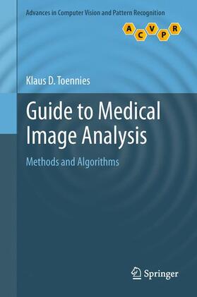 Toennies |  Guide to Medical Image Analysis | Buch |  Sack Fachmedien