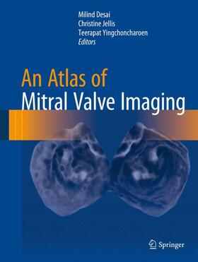 Desai / Yingchoncharoen / Jellis |  An Atlas of Mitral Valve Imaging | Buch |  Sack Fachmedien