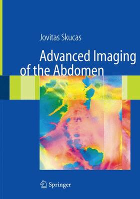 Skucas |  Advanced Imaging of the Abdomen | Buch |  Sack Fachmedien