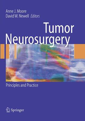 Newell / Moore |  Tumor Neurosurgery | Buch |  Sack Fachmedien