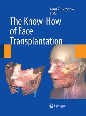 Siemionow |  The Know-How of Face Transplantation | Buch |  Sack Fachmedien