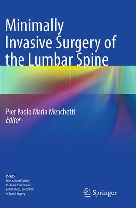 Menchetti |  Minimally Invasive Surgery of the Lumbar Spine | Buch |  Sack Fachmedien