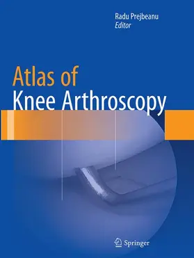 Prejbeanu |  Atlas of Knee Arthroscopy | Buch |  Sack Fachmedien