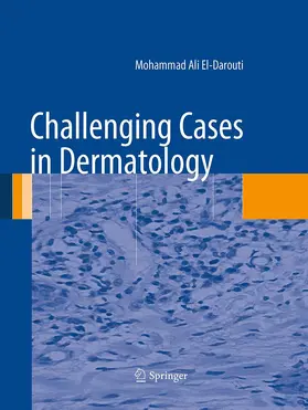 El-Darouti |  Challenging Cases in Dermatology | Buch |  Sack Fachmedien