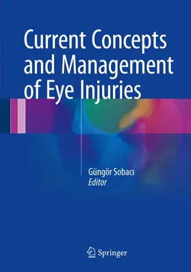 Sobaci / Sobaci |  Current Concepts and Management of Eye Injuries | Buch |  Sack Fachmedien