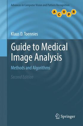 Toennies |  Guide to Medical Image Analysis | Buch |  Sack Fachmedien