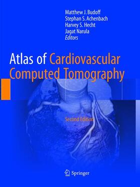Budoff / Narula / Achenbach |  Atlas of Cardiovascular Computed Tomography | Buch |  Sack Fachmedien