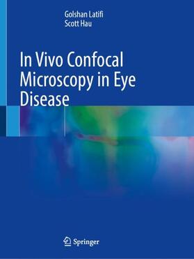 Hau / Latifi |  In Vivo Confocal Microscopy in Eye Disease | Buch |  Sack Fachmedien