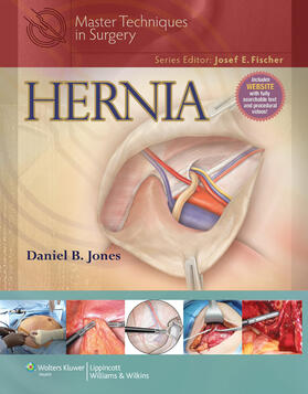 Jones |  Master Techniques in Surgery: Hernia | Buch |  Sack Fachmedien