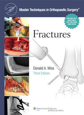 Wiss |  Master Techniques in Orthopaedic Surgery: Fractures | Buch |  Sack Fachmedien