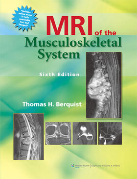 Berquist |  MRI of the Musculoskeletal System | Buch |  Sack Fachmedien
