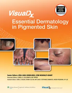 Goldsmith / Papier |  VisualDx: Essential Dermatology in Pigmented Skin | Buch |  Sack Fachmedien