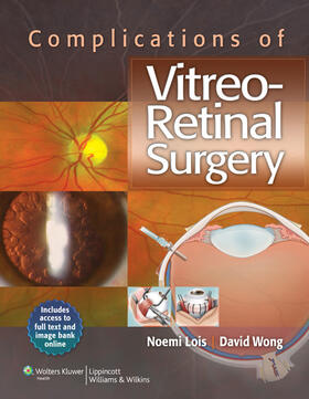 Lois / Wong | Complications of Vitreo-Retinal Surgery | Buch | 978-1-4511-1938-1 | sack.de