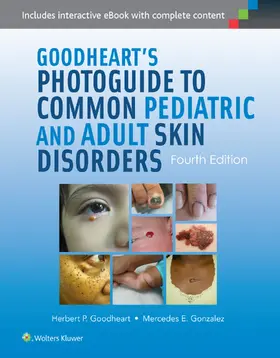 Goodheart / Gonzalez |  Goodheart's Photoguide to Common Pediatric and Adult Skin Disorders | Buch |  Sack Fachmedien