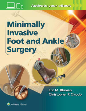 Bluman / Chiodo |  Minimally Invasive Foot & Ankle Surgery | Buch |  Sack Fachmedien