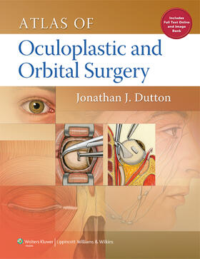 Dutton | Atlas of Oculoplastic and Orbital Surgery | Buch | 978-1-4511-4312-6 | sack.de
