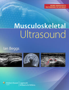 Beggs |  Musculoskeletal Ultrasound | Buch |  Sack Fachmedien