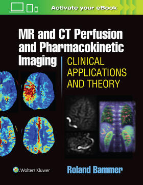 Bammer |  MR and CT Perfusion and Pharmacokinetic Imaging: Clinical Applications and Theoretical Principles | Buch |  Sack Fachmedien