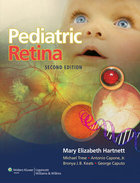 Hartnett |  Pediatric Retina | Buch |  Sack Fachmedien