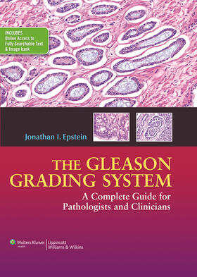 Epstein |  Epstein, J: Gleason Grading System | Buch |  Sack Fachmedien