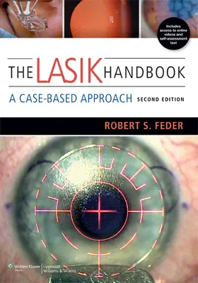 Feder |  The Lasik Handbook 2e PB: A Case-Based Approach | Buch |  Sack Fachmedien