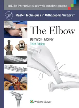 Morrey | Master Techniques in Orthopaedic Surgery: The Elbow | Buch | 978-1-4511-7309-3 | sack.de