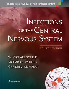 Scheld / Whitley / Marra |  Infections of the Central Nervous System | Buch |  Sack Fachmedien