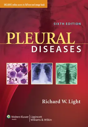 Light |  Pleural Diseases with Access Code | Buch |  Sack Fachmedien