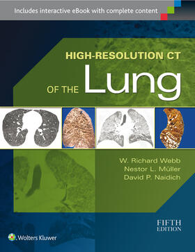 Webb / Muller / Naidich |  High-Resolution CT of the Lung | Buch |  Sack Fachmedien
