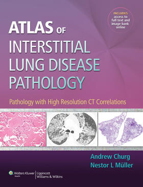 Churg / Müller |  Atlas of Interstitial Lung Disease Pathology | Buch |  Sack Fachmedien