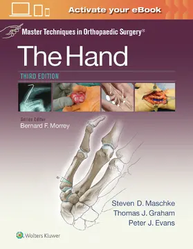 Maschke / Graham / Evans | Master Techniques in Orthopaedic Surgery: The Hand | Buch | 978-1-4511-8278-1 | sack.de