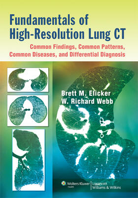 Elicker / Webb |  Fundamentals of High-resolution Lung CT | Buch |  Sack Fachmedien