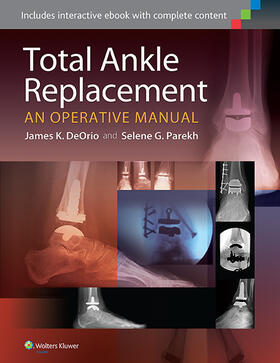 Parekh / DeOrio |  Total Ankle Replacement:  An Operative Manual | Buch |  Sack Fachmedien
